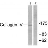 Western blot - Collagen IV Antibody from Signalway Antibody (33342) - Antibodies.com