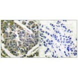 Immunohistochemistry - Collagen IV Antibody from Signalway Antibody (33342) - Antibodies.com