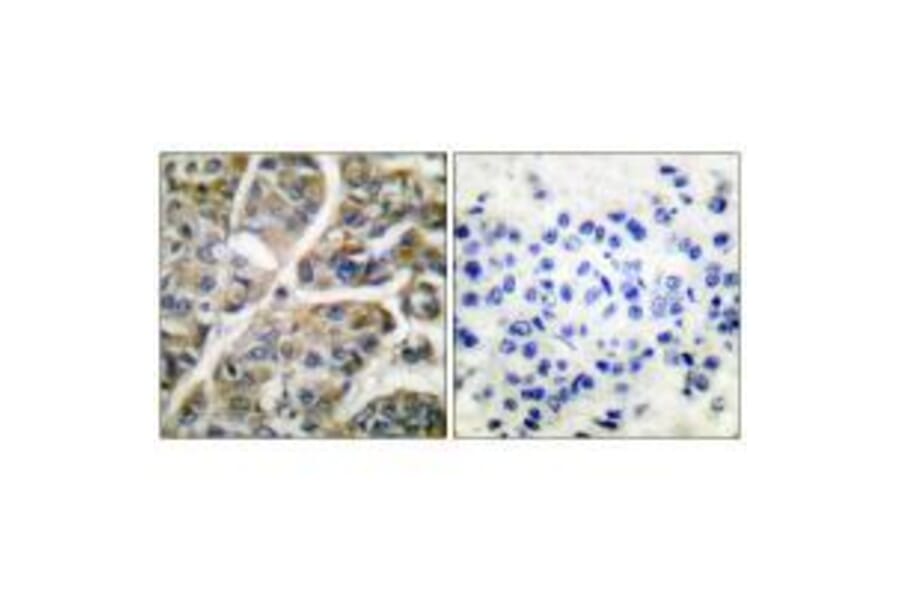 Immunohistochemistry - Granzyme B Antibody from Signalway Antibody (33394) - Antibodies.com