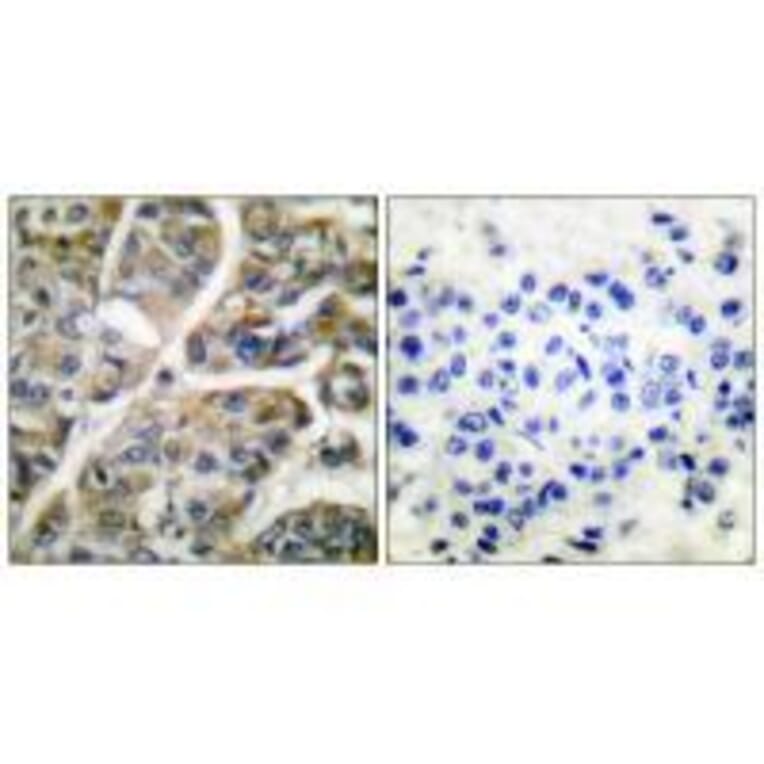 Immunohistochemistry - Granzyme B Antibody from Signalway Antibody (33394) - Antibodies.com