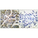 Immunohistochemistry - Granzyme B Antibody from Signalway Antibody (33394) - Antibodies.com