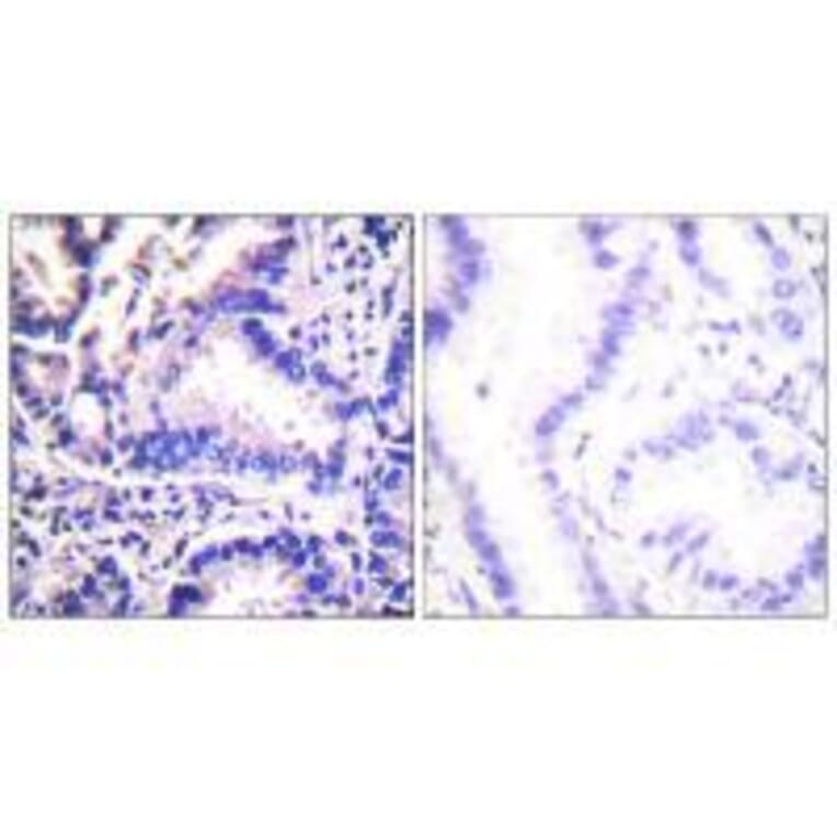 Immunohistochemistry - Synuclein γ Antibody from Signalway Antibody (33493) - Antibodies.com