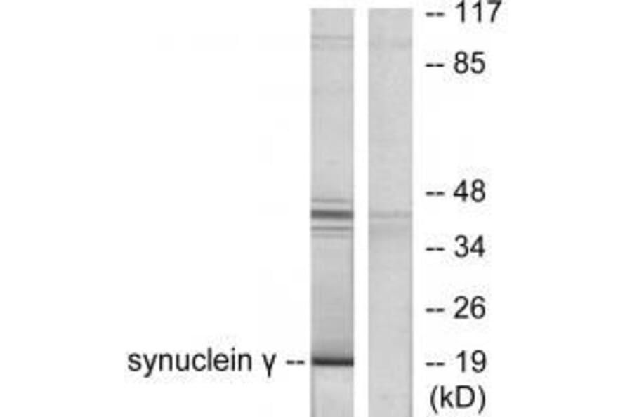 Western blot - Synuclein γ Antibody from Signalway Antibody (33493) - Antibodies.com