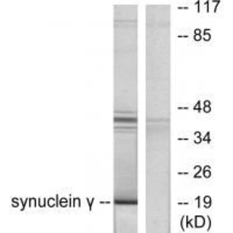 Western blot - Synuclein γ Antibody from Signalway Antibody (33493) - Antibodies.com