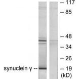 Western blot - Synuclein γ Antibody from Signalway Antibody (33493) - Antibodies.com