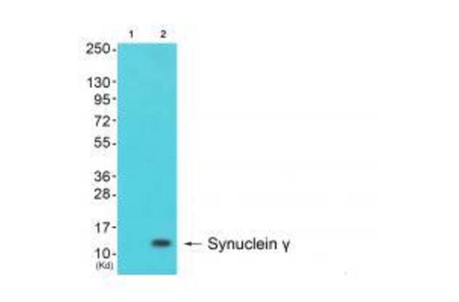Western blot - Synuclein γ Antibody from Signalway Antibody (33493) - Antibodies.com