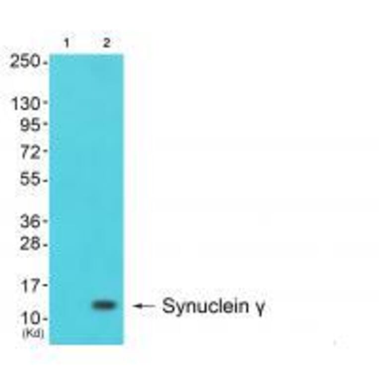 Western blot - Synuclein γ Antibody from Signalway Antibody (33493) - Antibodies.com