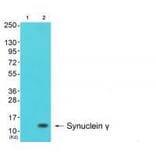 Western blot - Synuclein γ Antibody from Signalway Antibody (33493) - Antibodies.com