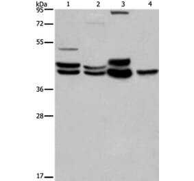 MAPK1/MAPK3 Antibody from Signalway Antibody (36846) - Antibodies.com