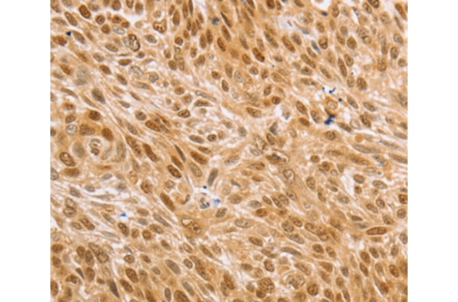 Immunohistochemistry - MAPK1/MAPK3 Antibody from Signalway Antibody (36846) - Antibodies.com