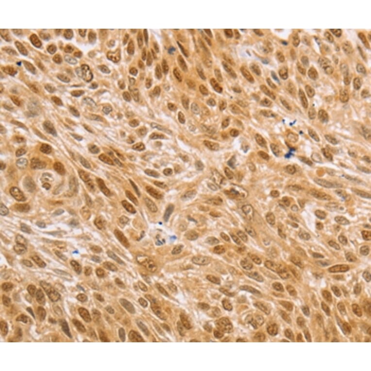 Immunohistochemistry - MAPK1/MAPK3 Antibody from Signalway Antibody (36846) - Antibodies.com