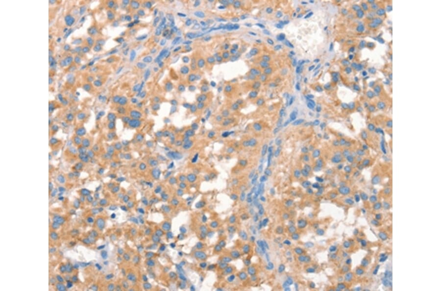 Immunohistochemistry - PRPS1/2/1L1 Antibody from Signalway Antibody (37130) - Antibodies.com