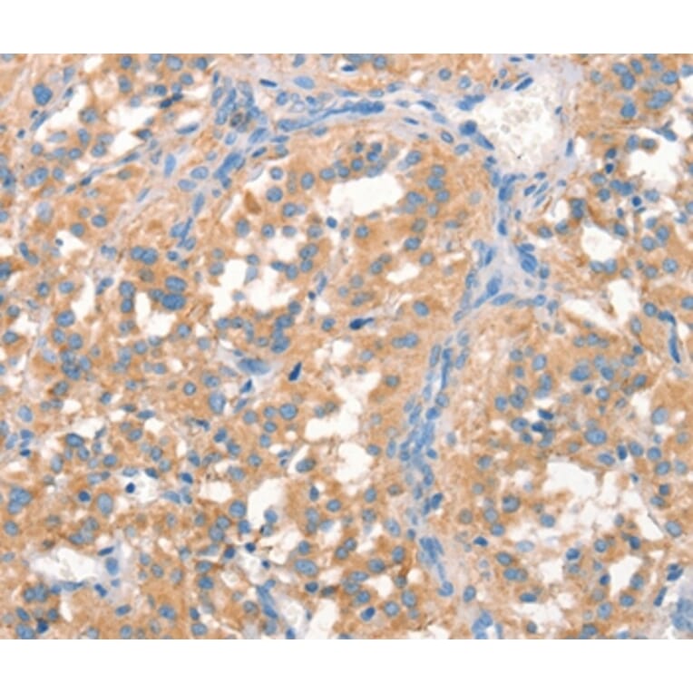 Immunohistochemistry - PRPS1/2/1L1 Antibody from Signalway Antibody (37130) - Antibodies.com