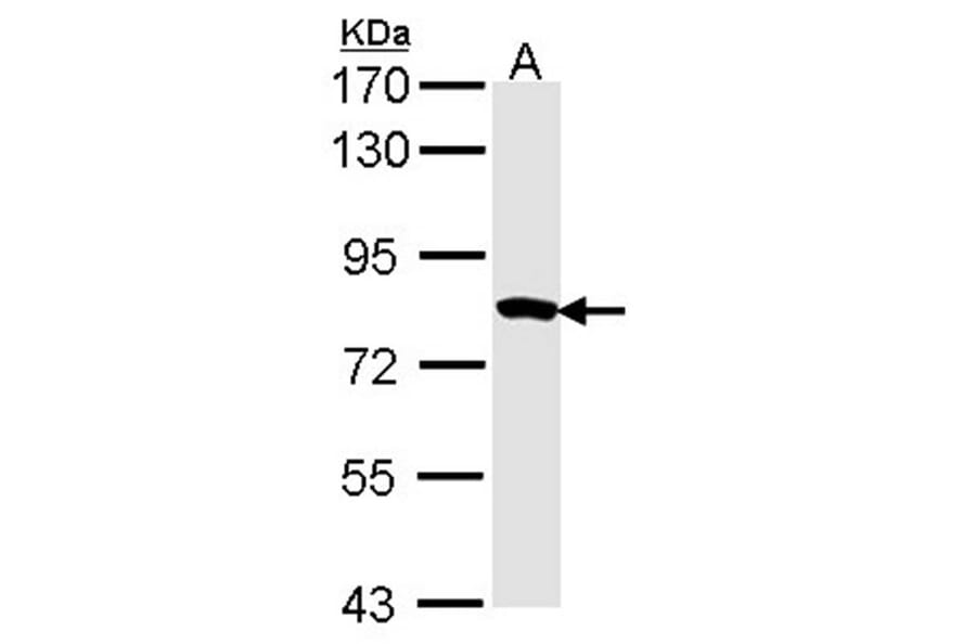 Myotubularin related protein 2 antibody from Signalway Antibody (22402) - Antibodies.com