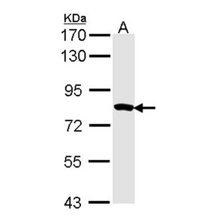 Myotubularin related protein 2 antibody from Signalway Antibody (22402) - Antibodies.com