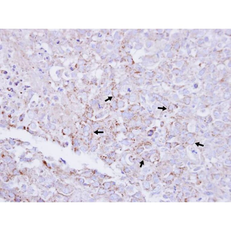 Immunohistochemistry - Myotubularin related protein 2 antibody from Signalway Antibody (22402) - Antibodies.com