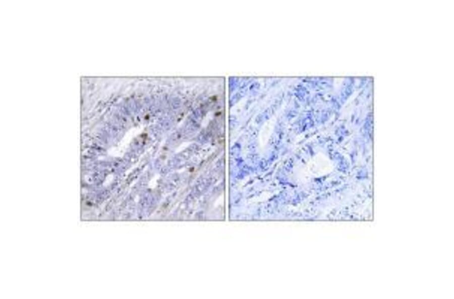 Immunohistochemistry - Nuclear Receptor NR4A1 (Ab-351) Antibody from Signalway Antibody (33181) - Antibodies.com