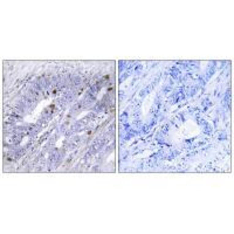 Immunohistochemistry - Nuclear Receptor NR4A1 (Ab-351) Antibody from Signalway Antibody (33181) - Antibodies.com