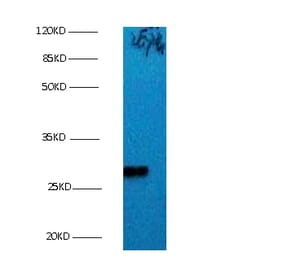 Bcl-2-like protein 1 Monoclonal Antibody from Signalway Antibody (42016) - Antibodies.com