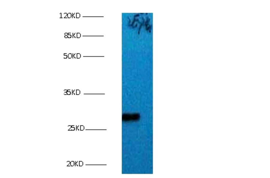 Bcl-2-like protein 1 Monoclonal Antibody from Signalway Antibody (42016) - Antibodies.com