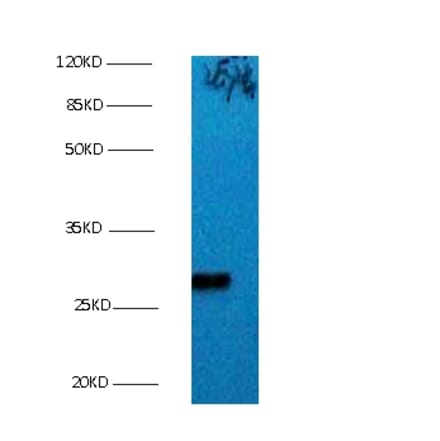 Bcl-2-like protein 1 Monoclonal Antibody from Signalway Antibody (42016) - Antibodies.com