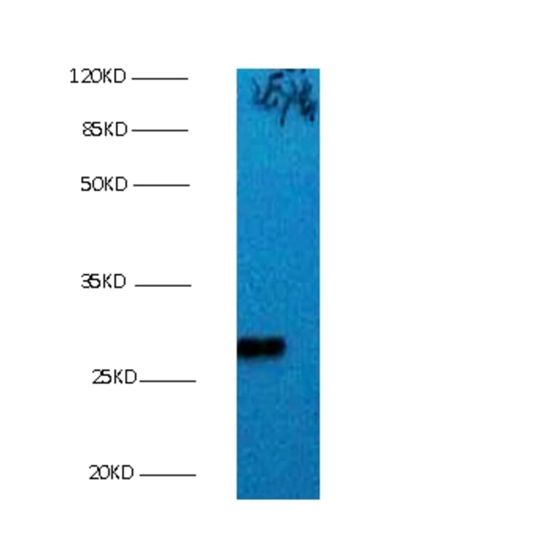 Bcl-2-like protein 1 Monoclonal Antibody from Signalway Antibody (42016) - Antibodies.com