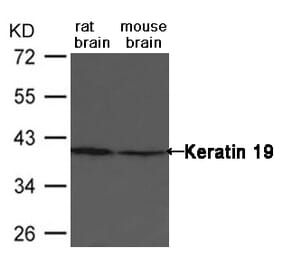 Western blot - Keratin 19 Antibody from Signalway Antibody (21615) - Antibodies.com
