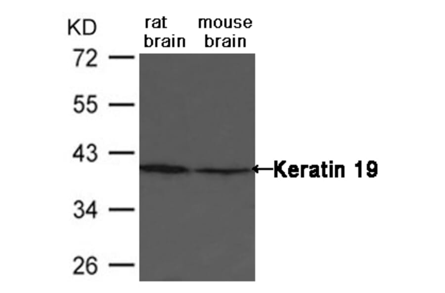 Western blot - Keratin 19 Antibody from Signalway Antibody (21615) - Antibodies.com