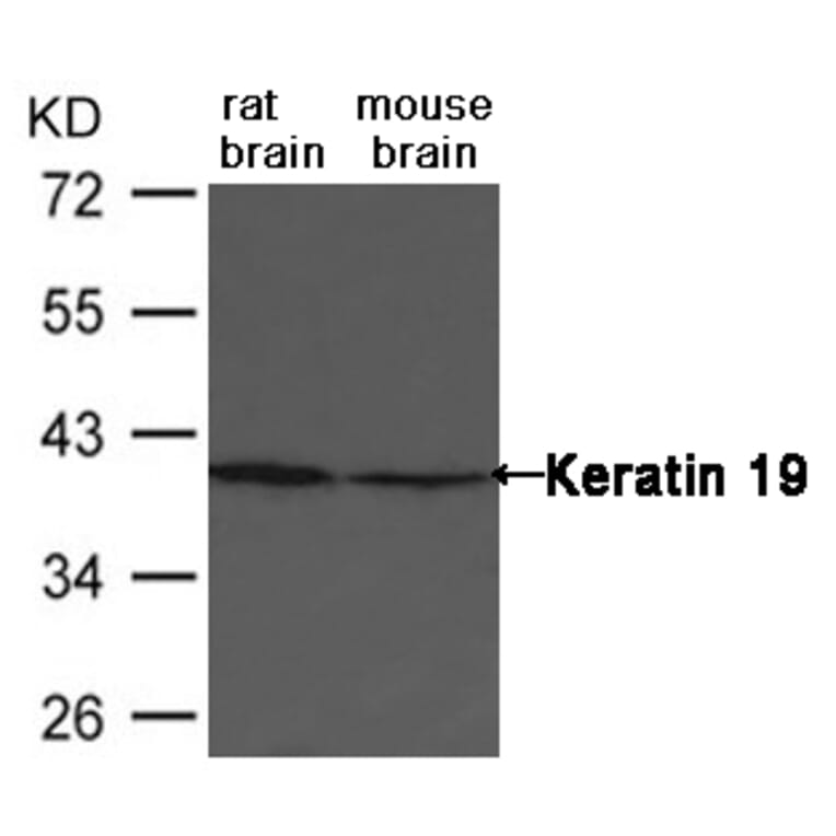 Western blot - Keratin 19 Antibody from Signalway Antibody (21615) - Antibodies.com