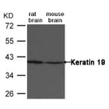 Western blot - Keratin 19 Antibody from Signalway Antibody (21615) - Antibodies.com