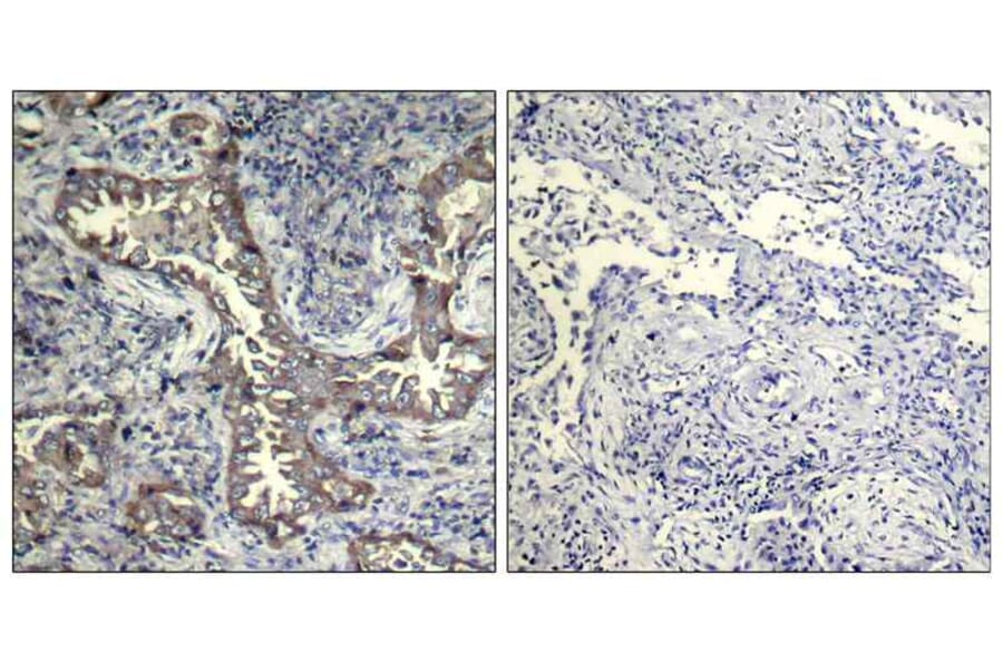 Immunohistochemistry - Keratin 19 Antibody from Signalway Antibody (21615) - Antibodies.com