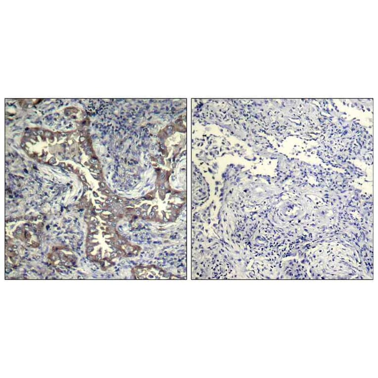 Immunohistochemistry - Keratin 19 Antibody from Signalway Antibody (21615) - Antibodies.com