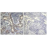 Immunohistochemistry - Keratin 19 Antibody from Signalway Antibody (21615) - Antibodies.com