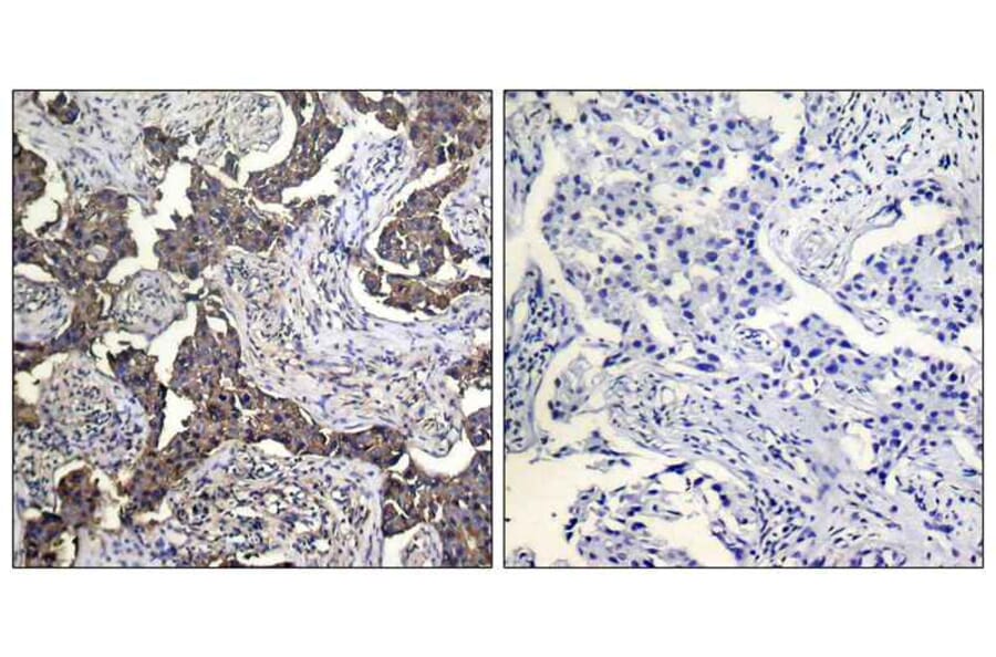 Immunohistochemistry - Keratin 19 Antibody from Signalway Antibody (21615) - Antibodies.com