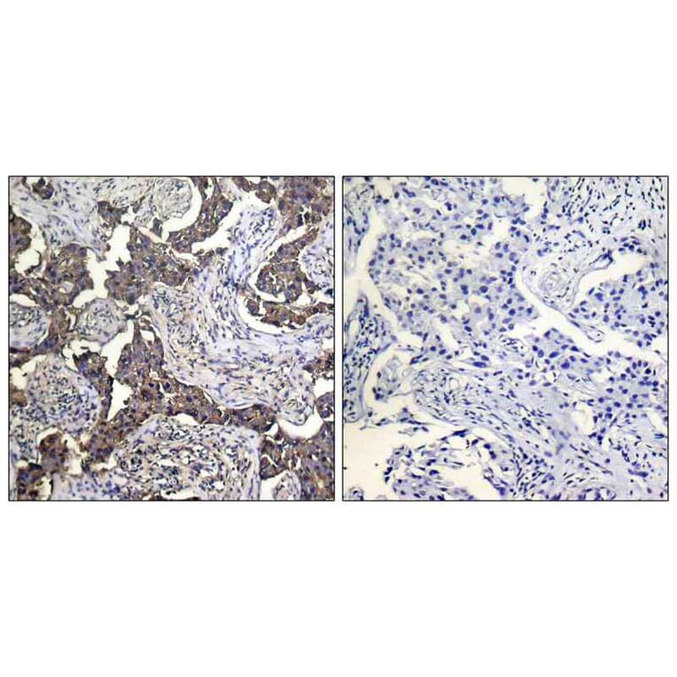 Immunohistochemistry - Keratin 19 Antibody from Signalway Antibody (21615) - Antibodies.com