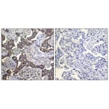 Immunohistochemistry - Keratin 19 Antibody from Signalway Antibody (21615) - Antibodies.com