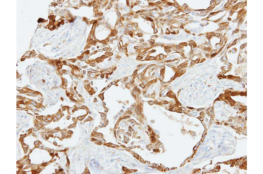 Immunohistochemistry - Fibulin-2 antibody from Signalway Antibody (22103) - Antibodies.com