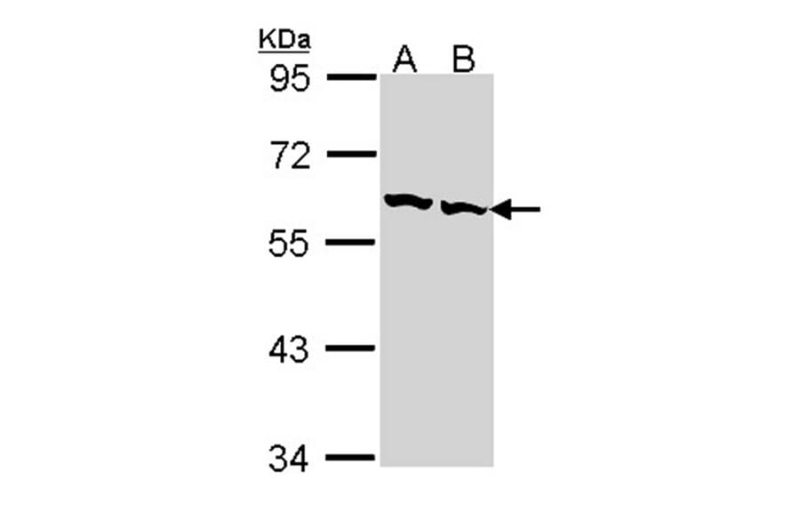 TCP-1 beta antibody from Signalway Antibody (22463) - Antibodies.com