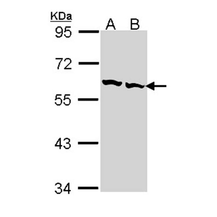 TCP-1 beta antibody from Signalway Antibody (22463) - Antibodies.com