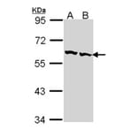 TCP-1 beta antibody from Signalway Antibody (22463) - Antibodies.com