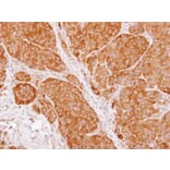 Immunohistochemistry - TCP-1 beta antibody from Signalway Antibody (22463) - Antibodies.com