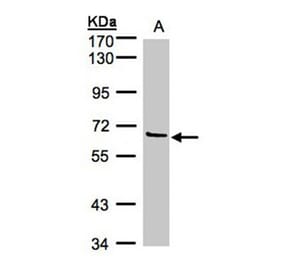 Factor XI antibody from Signalway Antibody (22658) - Antibodies.com