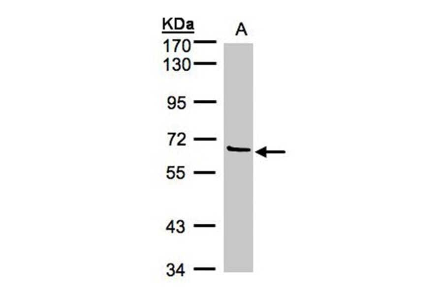Factor XI antibody from Signalway Antibody (22658) - Antibodies.com