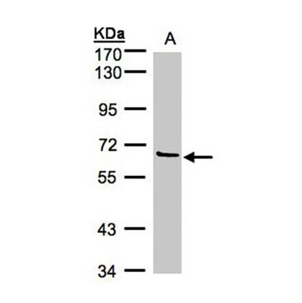 Factor XI antibody from Signalway Antibody (22658) - Antibodies.com