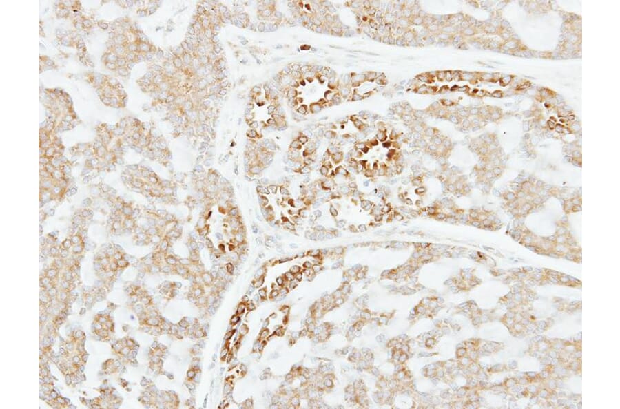 Immunohistochemistry - Factor XI antibody from Signalway Antibody (22658) - Antibodies.com