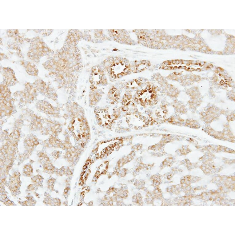 Immunohistochemistry - Factor XI antibody from Signalway Antibody (22658) - Antibodies.com