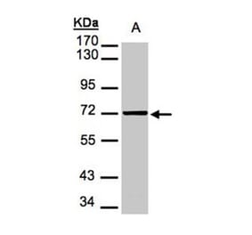 Mesothelin antibody from Signalway Antibody (22884) - Antibodies.com