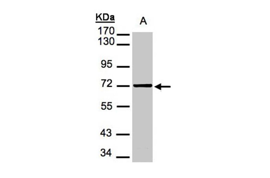 Mesothelin antibody from Signalway Antibody (22884) - Antibodies.com
