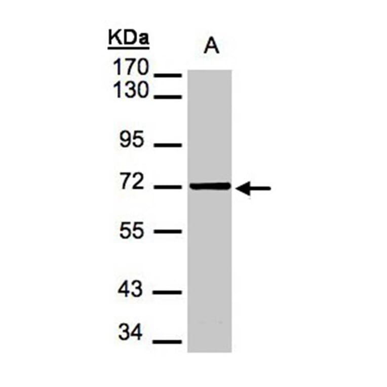 Mesothelin antibody from Signalway Antibody (22884) - Antibodies.com