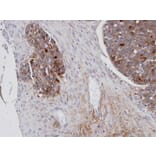 Immunohistochemistry - Mesothelin antibody from Signalway Antibody (22884) - Antibodies.com